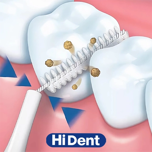 تمیزکردن بین دندان با مسواک های دنت