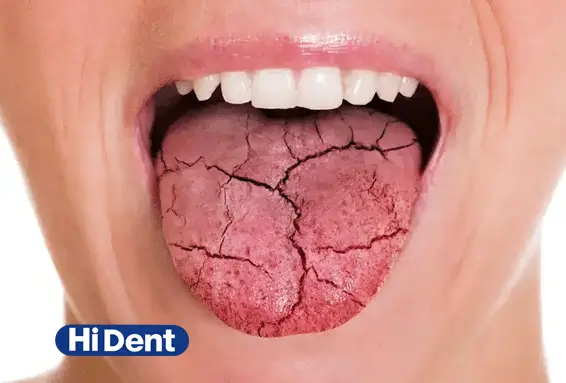تاثیر دیابت بر سلامت دهان